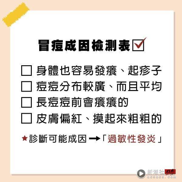 下巴痘痘反复长？下巴长痘痘原因、改善方法详解，8款“克下巴痘”神品推荐！ 最新 图4张