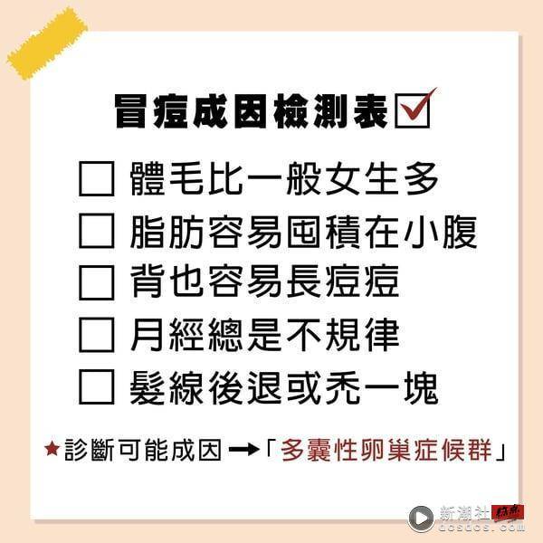 下巴痘痘反复长？下巴长痘痘原因、改善方法详解，8款“克下巴痘”神品推荐！ 最新 图3张